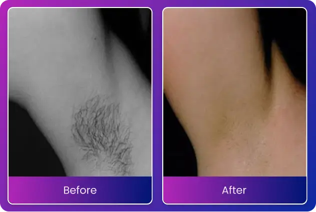 before-after-1