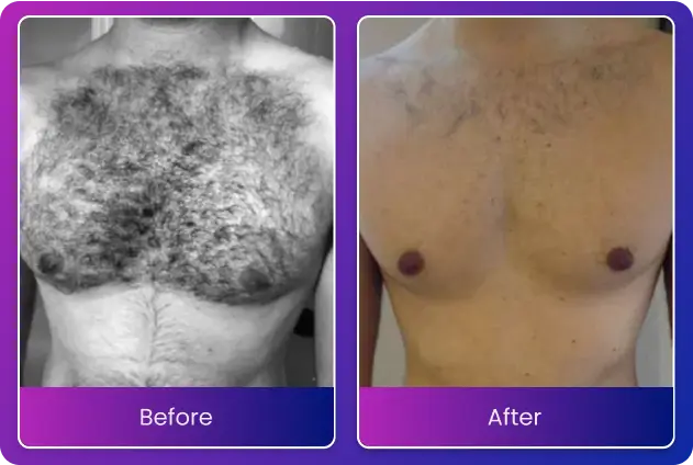 before-after-2